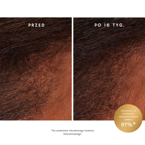 MOROCCANOIL SCALP Revitalizing tonik rewitalizujący do skóry głowy 100 ml - 3