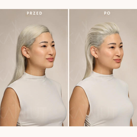 MOROCCANOIL VOLUME Root Boost spray wzmacniający włosy u nasady 250 ml - 3